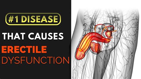 What Nerve Damage Cause Erectile Dysfunction